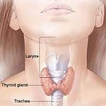 thyroide et medecine chinoise MTC